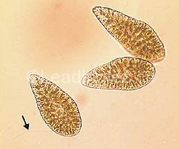 海洋卡盾藻 Chattonella marina