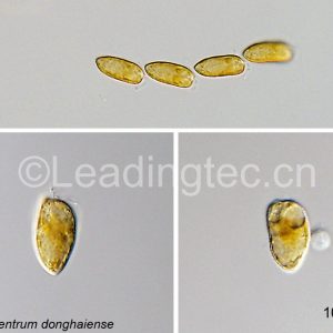 東海原甲藻(GY-H40 Prorocentrum donghaiense)