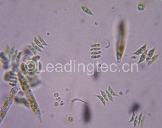 顯微鏡下才能看清綠藻的結(jié)構(gòu)。?