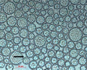 圖12. 裂殖壺菌（by Raghukumar, 2008），當(dāng)前DHA藻油生產(chǎn)的主力藻種之一