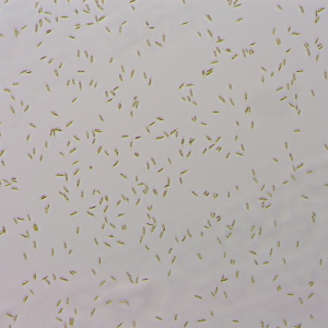 小新月菱形藻（GY-H8 Nitzschia closterium f.minutissima）