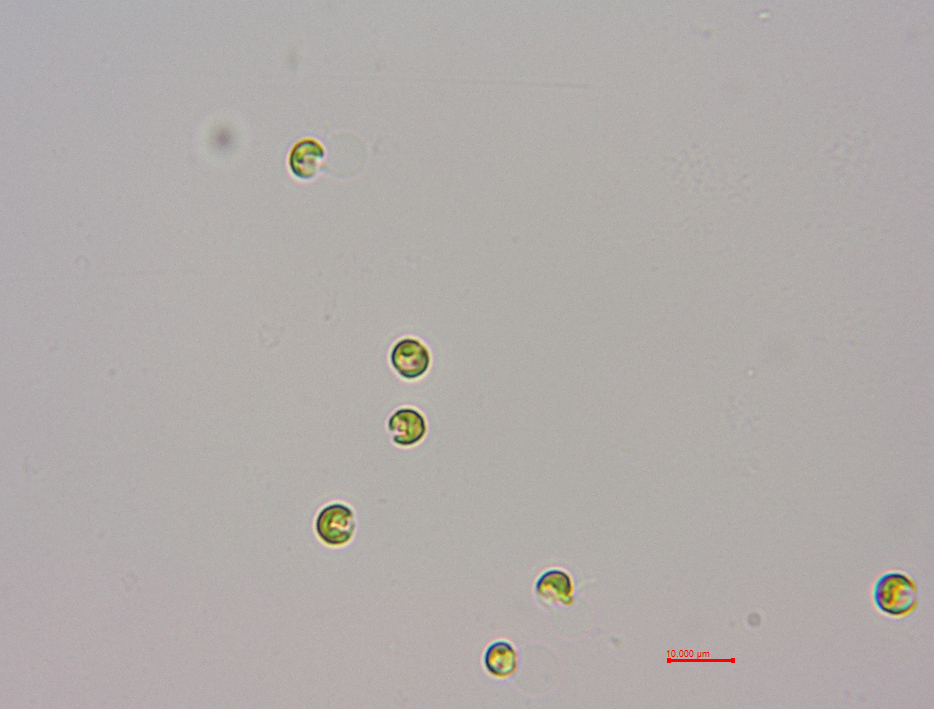 球形棕囊藻(GY-H37 Phaeocystis globsa)